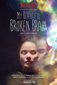 My Beautiful Broken Brain streaming